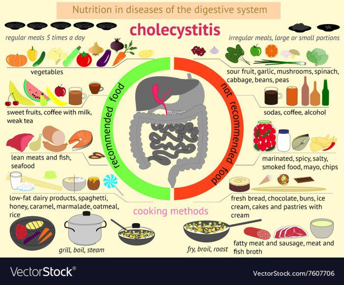 Acute cholecystitis diet
